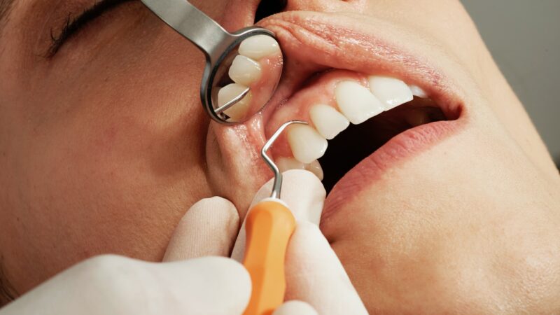 7 Tipps zur Erhaltung einer guten Mundgesundheit